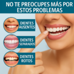 Carillas Ajustables – La Sonrisa que Siempre Soñaste - Imagen 2
