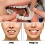 Carillas Ajustables – La Sonrisa que Siempre Soñaste - Imagen 4