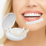 Carillas Ajustables – La Sonrisa que Siempre Soñaste