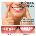 Carillas Ajustables – La Sonrisa que Siempre Soñaste - Imagen 3